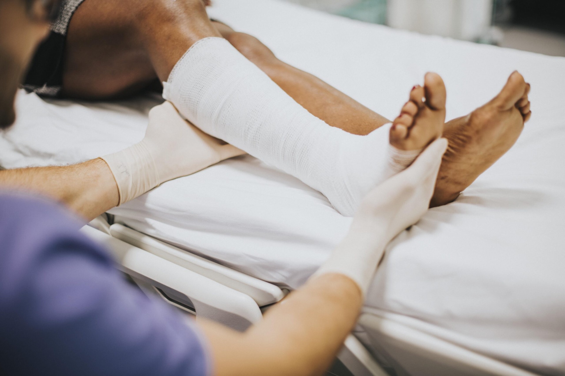Medical professional applying a cast to a patient's fractured leg