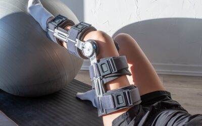 ACL Reconstruction: Expert Insights on the Procedure and Recovery